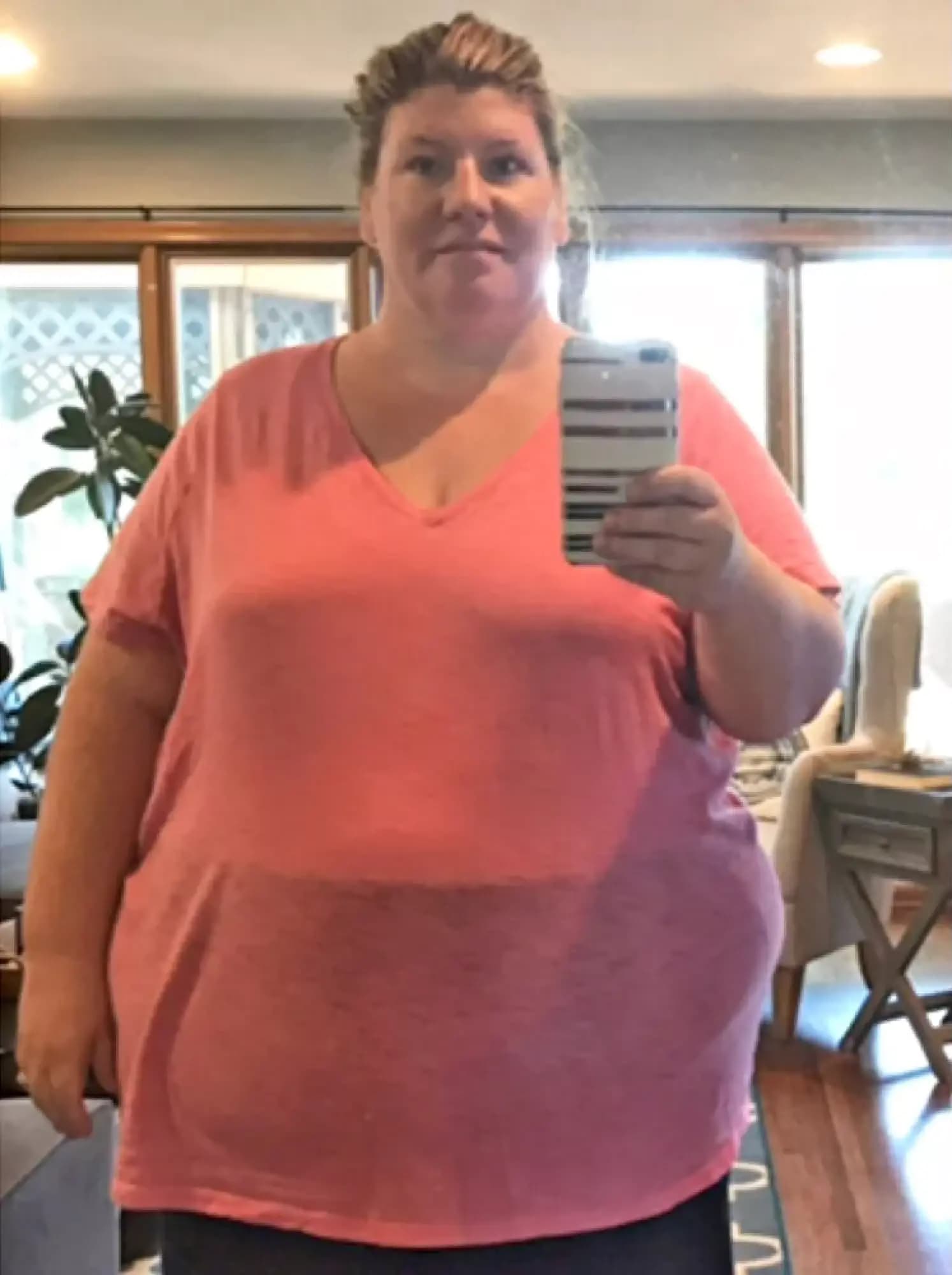 Month 0